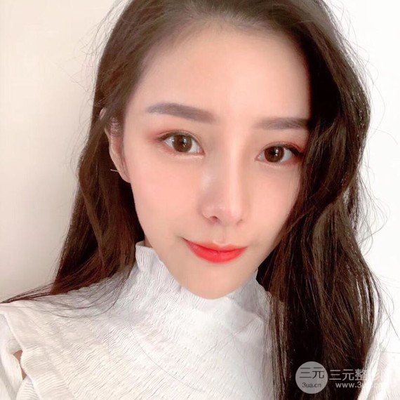 【隆鼻整形+進(jìn)口假體+耳軟骨墊鼻尖+鼻頭鼻翼縮小+鼻尖延長】綜合改良！