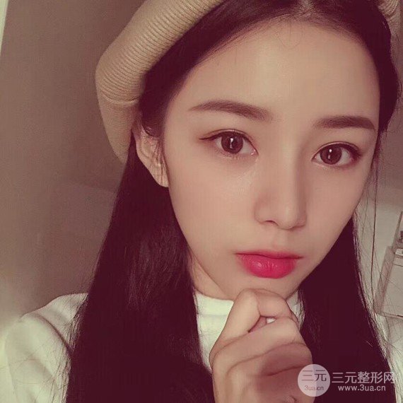 【隆鼻整形+進(jìn)口假體+耳軟骨墊鼻尖+鼻頭鼻翼縮小+鼻尖延長】綜合改良！