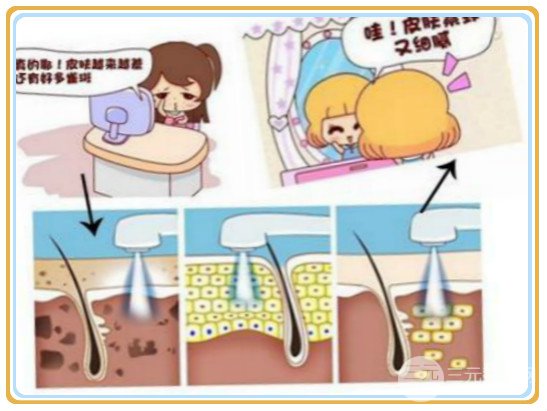 上海光子嫩膚一次要多少錢？價格影響有？