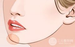 玻尿酸墊下巴后注意事項，術后護理要認真！