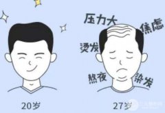 武漢緩解脫發(fā)價格貴不貴?影響價格的因素有哪些?