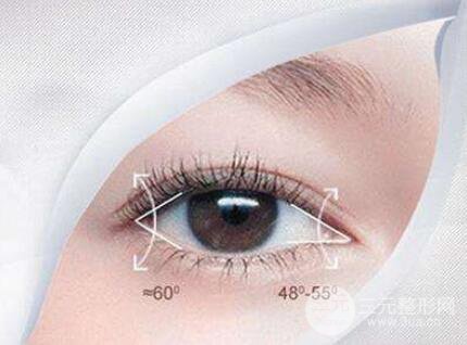 什么人適合開眼角手術(shù)?開眼角手術(shù)的適合人群?