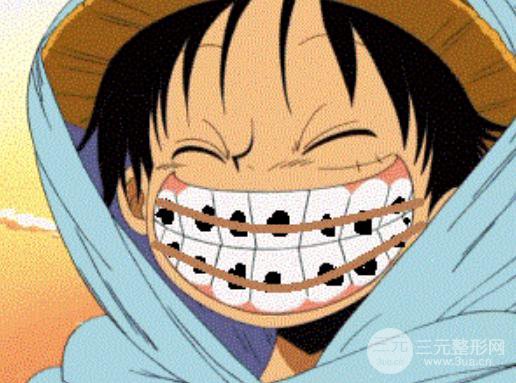 種植牙過程分為幾個(gè)步驟？會(huì)有副作用嗎？