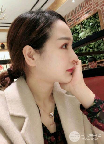 種發(fā)際線果圖