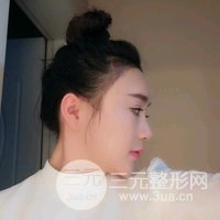 植發(fā)手術(shù)果