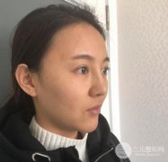 眉弓填充怎么樣？小姐姐分享在廣州華美做眉弓填充經(jīng)歷