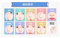 假體墊鼻基底從哪里做切口  墊鼻基底假體放在什么位置