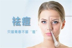 復(fù)合彩光祛痘多少錢?成好嗎