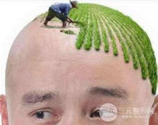 植發(fā)怎么樣？果*嗎？