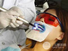 冷光美白牙齒需要多少錢