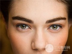 北京開內(nèi)眼角需要多少錢