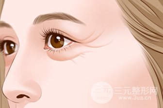 吸脂術(shù)去眼袋有無什么副作用