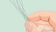 用藥多久后，可以考慮植發(fā)?