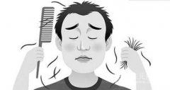 青年男性脫發(fā)怎么辦？緩解脫發(fā)方法都有哪些呢？