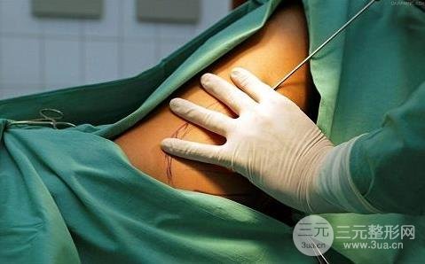 大腿吸脂風(fēng)險