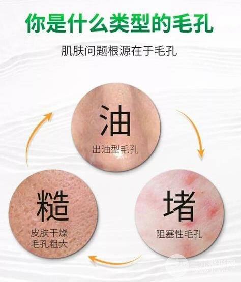 臉部毛孔收縮小竅門