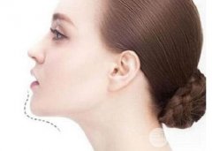 墊下巴的價格是多少~|科普攻略篇 盆友們了解下