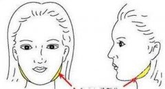 下頜角磨骨整形總是備受矚目 還不是因為這個原因