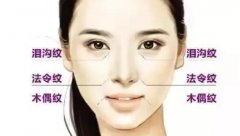 注射瘦臉注射除皺讓女人的美發(fā)揮到“無齡感”！