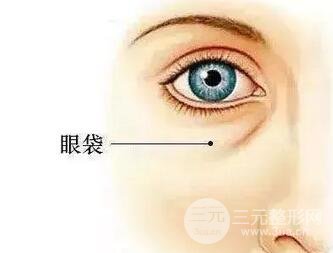 內(nèi)切祛眼袋