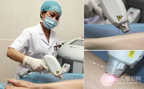 西安西京醫(yī)院脫毛價格