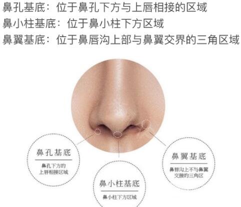 假體墊鼻基底有什么用 果好不好