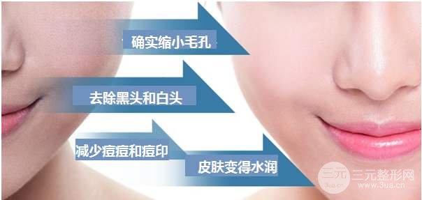 盤點一下黑臉娃娃價格，一療程費用詳情！