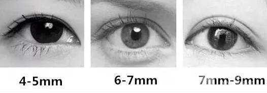 雙眼皮修復(fù)手術(shù)的時(shí)間