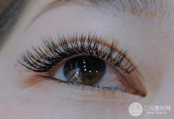 雙眼皮修復手術(shù)應(yīng)該幾天之后進行還是幾個月之后？