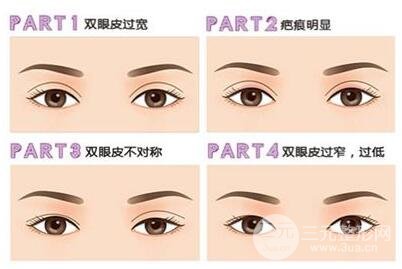 雙眼皮手術(shù)失敗的原因