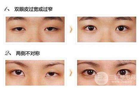 術(shù)后注意事項