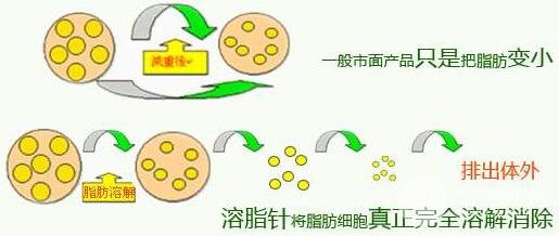 注射溶脂的副作用