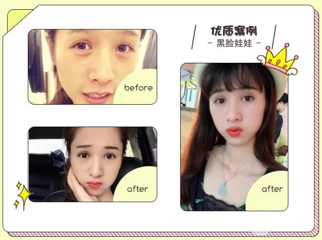 黑臉娃娃操作前