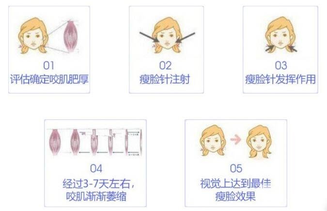 注射瘦臉果