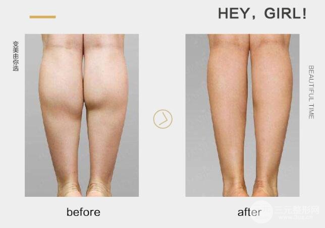 術(shù)后護(hù)理