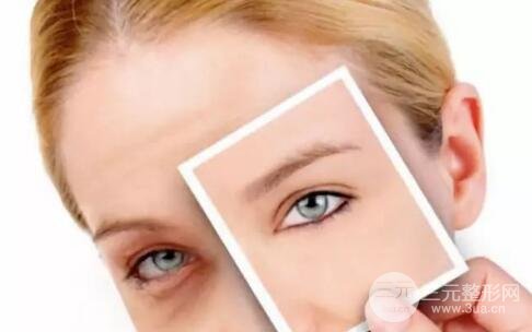 修復(fù)眼袋手術(shù)恢復(fù)時(shí)間是多久？