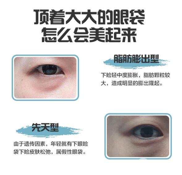 修復(fù)眼袋手術(shù)方式
