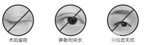 全切雙眼皮價(jià)格