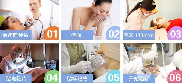 熱瑪吉的緩解過程