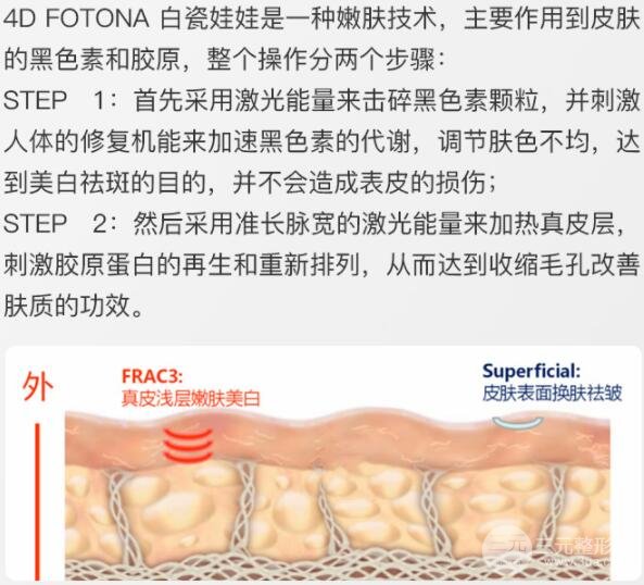 白瓷娃娃多少錢一次，美膚果圖~