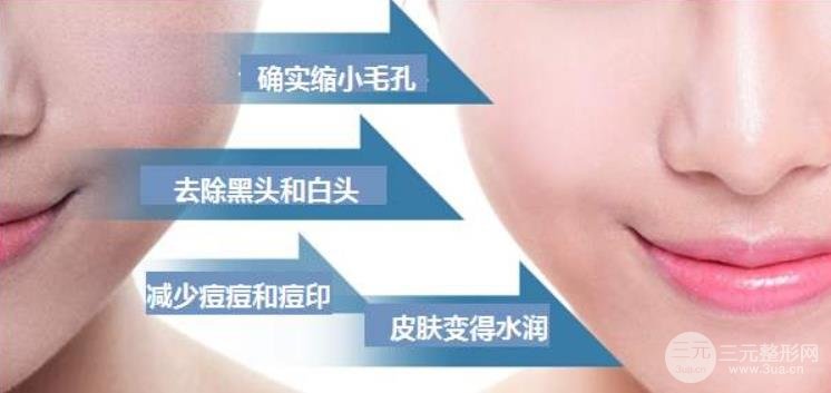 黑臉娃娃什么價格？所有人都適合做黑臉娃娃么~