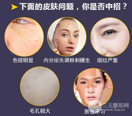 飛梭鐳射原理介紹