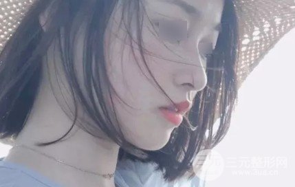 九江附屬醫(yī)院牙齒矯正過(guò)程