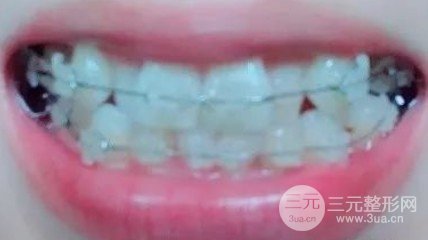 九江附屬醫(yī)院牙科好嗎