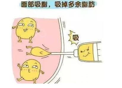 面部吸脂恢復(fù)期