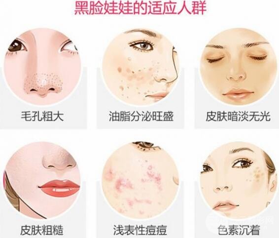 [美膚攻略]黑臉娃娃費用和果