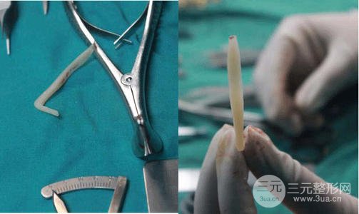 假體隆鼻注意事項有哪些呢？趕緊來科普一下吧~