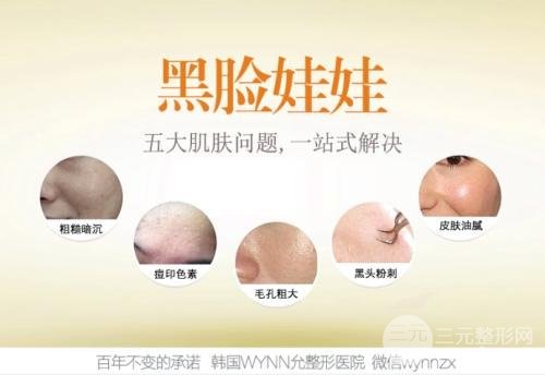 黑臉娃娃的費(fèi)用多少錢一次？黑臉娃娃果有哪些？