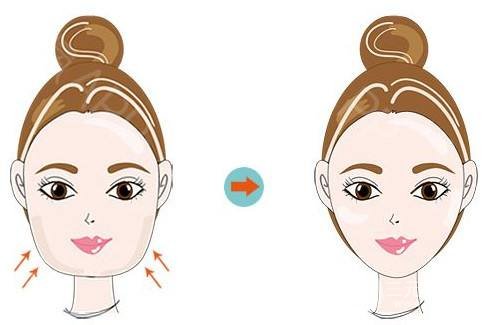 面部吸脂整形多久恢復自然？科普一下吧~