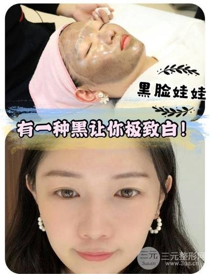 做黑臉娃娃后的注意事項